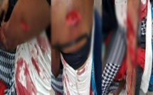  «Coépouse charcutée» : la sentence est tombée pour Salimata Diaw