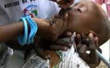 Ziguinchor-Campagne de supplémentation: 100 000 enfants seront vaccinés