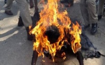 Nouackchott : Mort d'une Sénégalaise brûlée au 3e degré