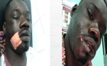 Du nouveau dans l’agression de Guin Thieuss : le parquet ouvre une information judiciaire