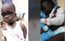 Enfant « maltraité » à Mbour: le procureur dit ne pas avoir assez d’élément pour inculper la belle-mère