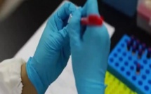 Coronavirus Sénégal: on s’est trompé sur les tests des 10 médecins de l’ORL Fann déclarés positifs 