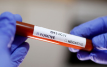 Coronavirus: l'institut Pasteur reconnaît des dysfonctionnements dans l'analyse des tests