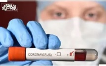 Covid-19: en Mauritanie, une biologiste arrêtée après avoir douté des chiffres officiels