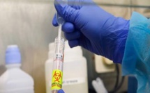Covid-19 : le kit de diagnostic rapide disponible en début 2021 (Institut Pasteur de Dakar)