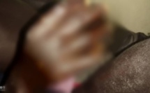 Panique à Thiaroye-sur-mer: une maladie mystérieuse fait des ravages épidermiques chez les pêcheurs