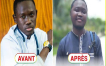 L'étudiant SOD évacué à Bordeaux, plus de 272 millions F Cfa mobilisés