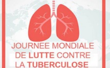 Lutte contre la tuberculose : 86% des malades sous traitement guérissent en Côte d`Ivoire