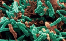 Tuberculose : nouveau test prometteur