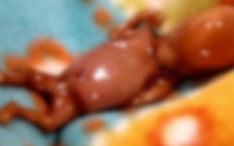 Golf Sud : Un sachet contenant un fœtus et du matériel médical trouvé devant un immeuble