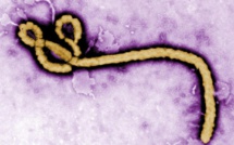 Un échantillon de virus Ebola volé en Guinée