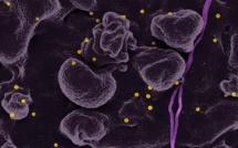 Fièvre hémorragique de Crimée-Congo: tout comprendre sur la maladie