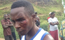 Au Burundi, des représailles au quotidien