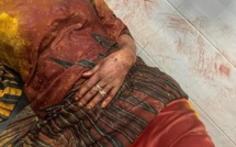 Agression de Maimouna Ndour Faye : la directrice de 7tv poignardée devant sa maison 