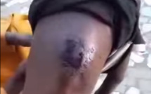 ​Touba : un maître coranique tabasse et blesse un talibé