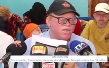 Sénégal : Le président de l’association nationale des albinos détourne 33 millions F CFA