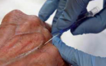 Prise en charge des zoonoses au Sénégal : la rage, une pathologie qui inquiète