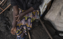 RDC: l'épidémie de mpox inquiète les parents d'élèves pour la rentrée scolaire