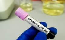 Fièvre de la Vallée du Rift : 21 cas confirmés dont 7 décès (Ministre)