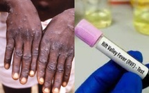 Fièvre de la vallée du Rift : 277 cas confirmés, 22 décès, 207 déclarés guéries, Saint-Louis en zone rouge (officiel)