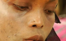 Mali: Période de grande chaleur, un moment d’enfer pour les femmes `` tchato ``